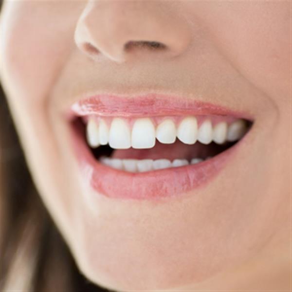 貴金屬<a href=http://m.f3bb6.cn/listinfo-829-0.html target=_blank class=infotextkey>烤瓷牙</a>效果持續(xù)時間