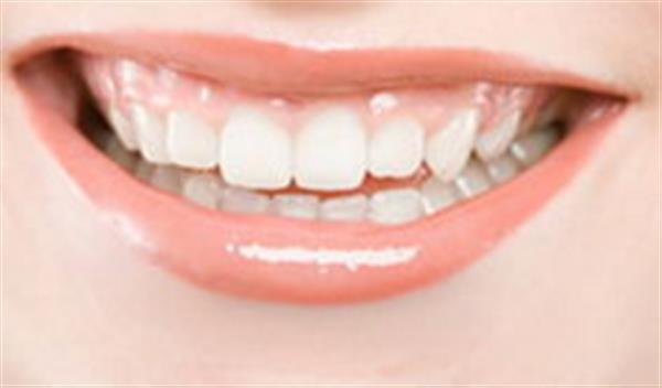 <a href=http://m.f3bb6.cn/listinfo-825-0.html target=_blank class=infotextkey>牙齒種植</a>與假牙的區(qū)別