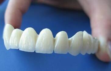 純鈦<a href=http://m.f3bb6.cn/listinfo-829-0.html target=_blank class=infotextkey>烤瓷牙</a>價(jià)格