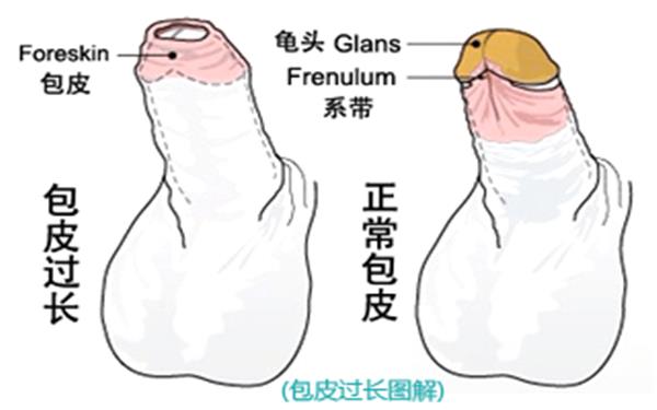 包皮手術要多少錢