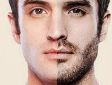 <a href=http://m.f3bb6.cn/listinfo-667-0.html target=_blank class=infotextkey>種植胡須</a>恢復(fù)時間