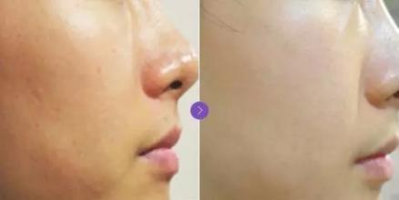 水光<a href=http://m.f3bb6.cn/listinfo-770-0.html target=_blank class=infotextkey>嫩膚</a>的危害