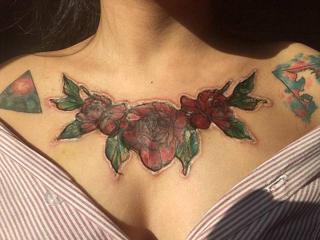 去紋身需要多少錢