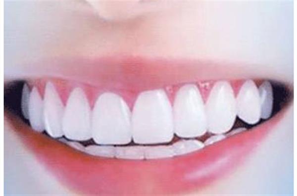 <a href=http://m.f3bb6.cn/listinfo-825-0.html target=_blank class=infotextkey>牙齒種植</a>后都要注意哪些問(wèn)題