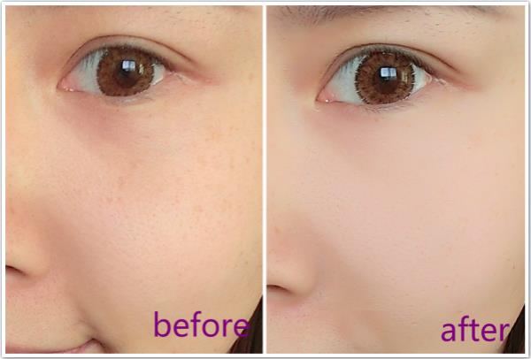 深圳彩光<a href=http://m.f3bb6.cn/listinfo-770-0.html target=_blank class=infotextkey>嫩膚</a>會(huì)對(duì)皮膚都有哪些副作用