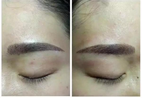 適合眉毛整形手術的有那些人群