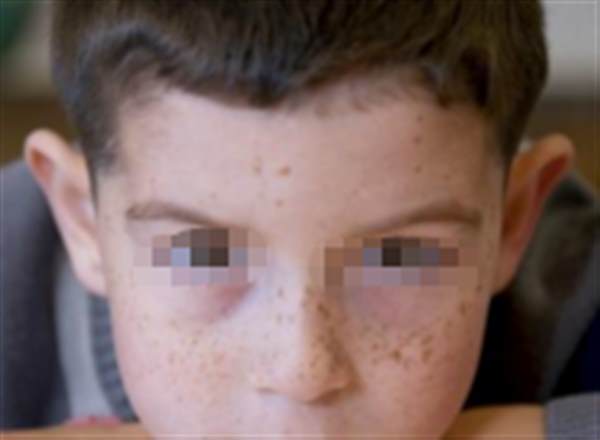 男士<a href=http://m.f3bb6.cn/listinfo-774-0.html target=_blank class=infotextkey>去雀斑</a>激光多少錢(qián)?