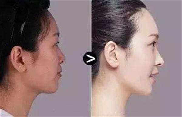 彩光<a href=http://m.f3bb6.cn/listinfo-770-0.html target=_blank class=infotextkey>嫩膚</a>主要有哪些特點(diǎn)