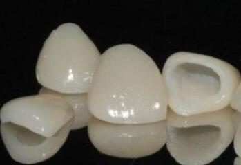 <a href=http://m.f3bb6.cn/listinfo-830-0.html target=_blank class=infotextkey>美容冠</a><a href=http://m.f3bb6.cn/listinfo-824-0.html target=_blank class=infotextkey>牙齒矯正</a>禁忌人群