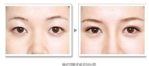 怎么變成<a href=http://m.f3bb6.cn/listinfo-724-0.html target=_blank class=infotextkey>雙眼皮</a>