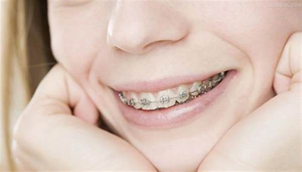 <a href=http://m.f3bb6.cn/listinfo-830-0.html target=_blank class=infotextkey>美容冠</a>的價錢受哪些因素的影響