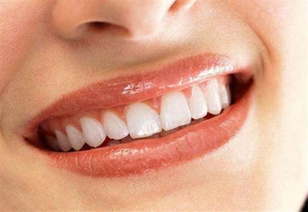 牙齒冷光美白副作用