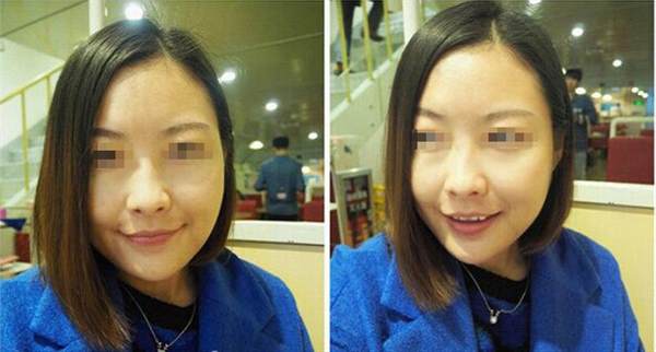 哪些人群不適合做光子<a href=http://m.f3bb6.cn/listinfo-770-0.html target=_blank class=infotextkey>嫩膚</a>呢