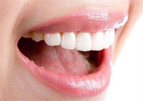 牙齒冷白光美白有什么禁忌