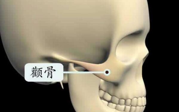 顴骨微整形多少錢