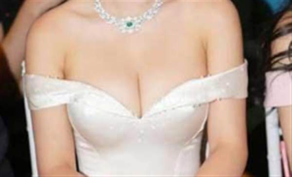 乳房下垂術(shù)多少錢