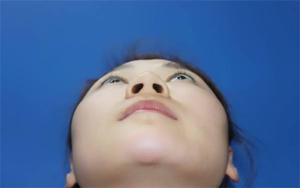 膨體<a href=http://m.f3bb6.cn/listinfo-737-0.html target=_blank class=infotextkey>隆鼻</a>術前術后的注意事項