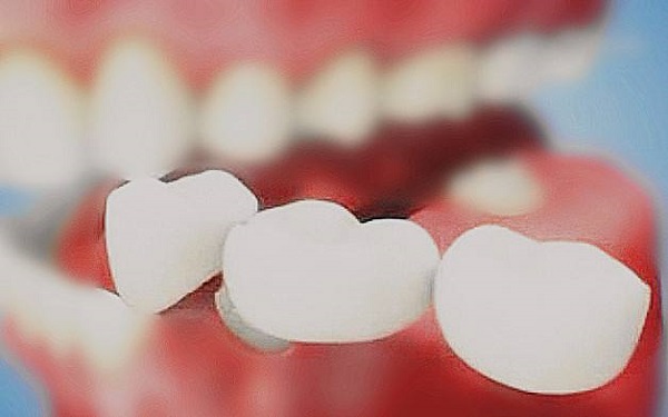 <a href=http://m.f3bb6.cn/listinfo-830-0.html target=_blank class=infotextkey>美容冠</a>多少錢一顆