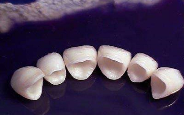 <a href=http://m.f3bb6.cn/listinfo-830-0.html target=_blank class=infotextkey>美容冠</a>副作用