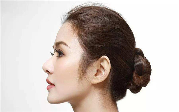 膨體<a href=http://m.f3bb6.cn/listinfo-737-0.html target=_blank class=infotextkey>隆鼻</a>失敗的表現有哪些