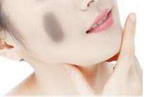 C6激光<a href=http://m.f3bb6.cn/listinfo-773-0.html target=_blank class=infotextkey>去胎記</a>效果好嗎