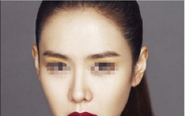 脫發際線多少錢