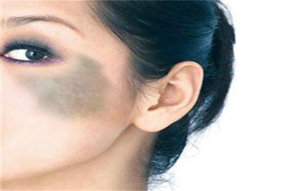 激光<a href=http://m.f3bb6.cn/listinfo-799-0.html target=_blank class=infotextkey>去太田痣</a>的費用