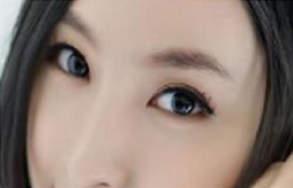 做<a href=http://m.f3bb6.cn/listinfo-650-0.html target=_blank class=infotextkey>眉部整形</a>術(shù)后如何注意護(hù)理