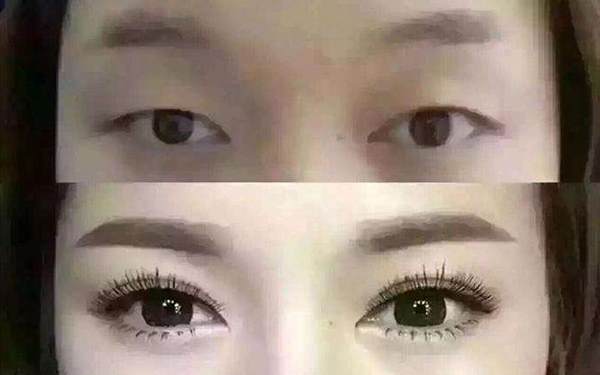 種眼睫毛前后對比圖