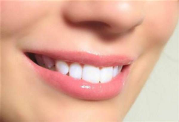 <a href=http://m.f3bb6.cn/listinfo-830-0.html target=_blank class=infotextkey>美容冠</a><a href=http://m.f3bb6.cn/listinfo-824-0.html target=_blank class=infotextkey>牙齒矯正</a>恢復時間