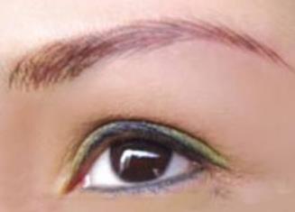 做了提眉手術注意事項