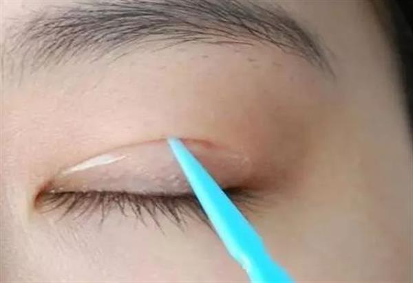 <a href=http://m.f3bb6.cn/listinfo-724-0.html target=_blank class=infotextkey>雙眼皮</a>貼貼久了會變<a href=http://m.f3bb6.cn/listinfo-724-0.html target=_blank class=infotextkey>雙眼皮</a>嗎