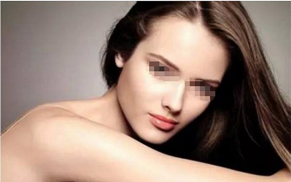 脫發際線的副作用