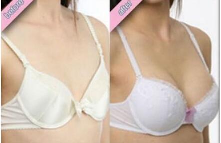 注射<a href=http://m.f3bb6.cn/listinfo-618-0.html target=_blank class=infotextkey>隆胸</a>安全嗎