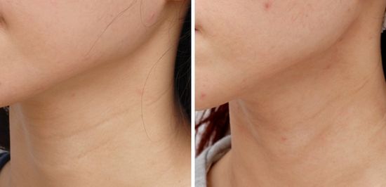 如何<a href=http://m.f3bb6.cn/listinfo-785-0.html target=_blank class=infotextkey>去頸紋</a>