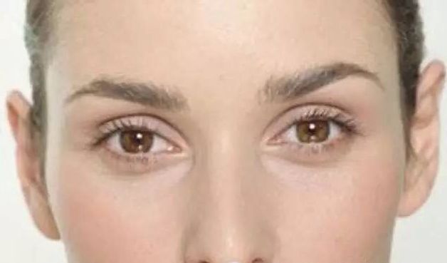 <a href=http://m.f3bb6.cn/listinfo-655-0.html target=_blank class=infotextkey>切眉</a>后增生了怎么辦