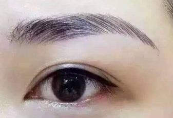 激光洗半長期紋身有效嗎