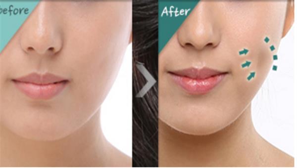 朝陽<a href=http://m.f3bb6.cn/listinfo-637-0.html target=_blank class=infotextkey>酒窩整形</a>手術價格因素