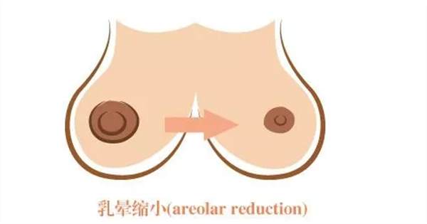 還在擔心乳暈問題嗎？粉嫩少女性就是現在！
