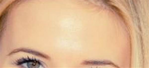 發(fā)際線調(diào)整需要多少錢