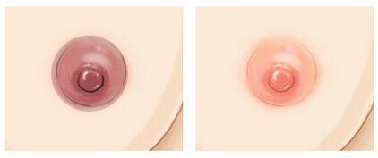 乳頭<a href=http://m.f3bb6.cn/listinfo-625-0.html target=_blank class=infotextkey>乳暈縮小</a>多少錢?