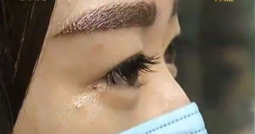 提眉術什么年齡適合做？