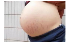 <a href=http://m.f3bb6.cn/listinfo-613-0.html target=_blank class=infotextkey>射頻</a><a href=http://m.f3bb6.cn/listinfo-791-0.html target=_blank class=infotextkey>去妊娠紋</a>價格