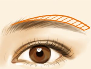 <a href=http://m.f3bb6.cn/listinfo-655-0.html target=_blank class=infotextkey>切眉</a>術后眼腫怎么辦？