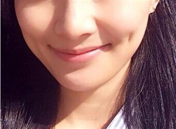 酒窩成形術適合所有的臉型嗎