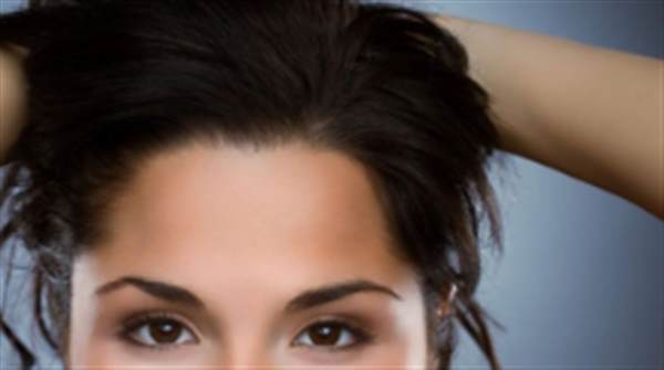 半長期發際線的弊端