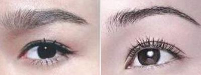 <a href=http://m.f3bb6.cn/listinfo-655-0.html target=_blank class=infotextkey>切眉</a>術適用范圍是什么？