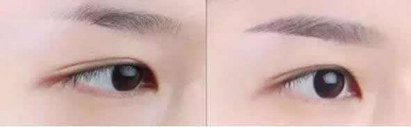 做<a href=http://m.f3bb6.cn/listinfo-655-0.html target=_blank class=infotextkey>切眉</a>術需要注意什么問題？