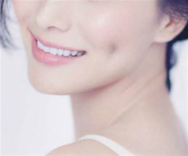 做個酒窩多少錢