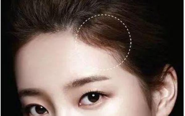 人造發際線種植的價格